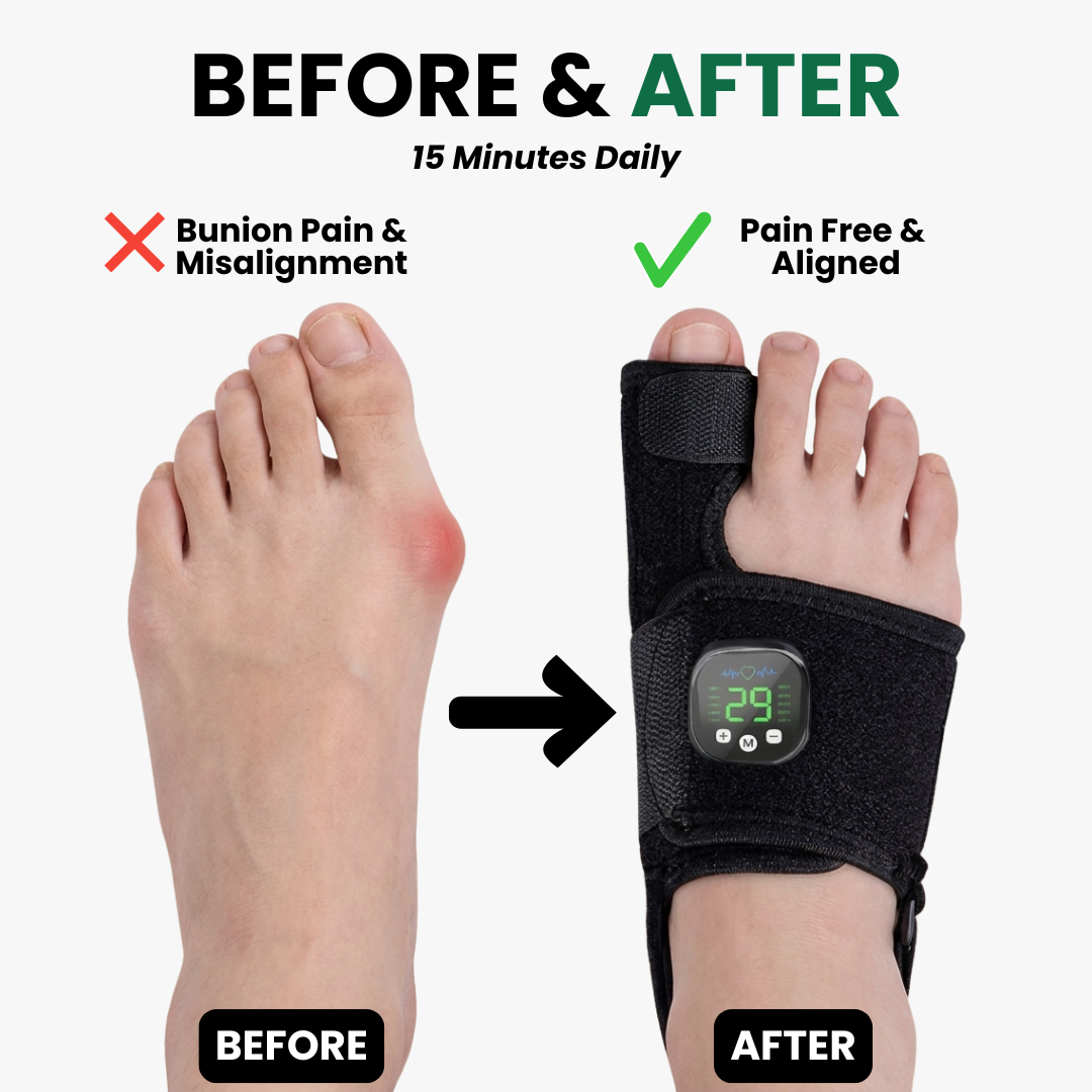 EMS Bunion Corrector