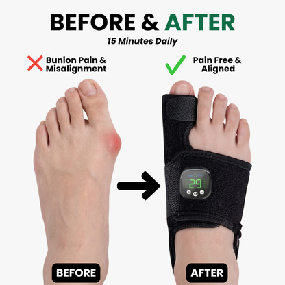 EMS Bunion Corrector